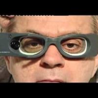 Meniere’s Disease